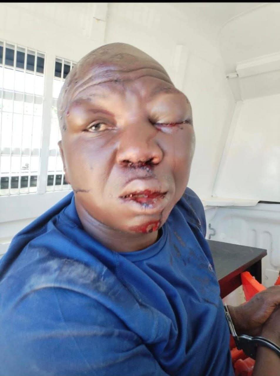 Suspected Car Hijacker Beaten Beyond Recognition by Angry Mob in Shocking Jungle Justice Incident